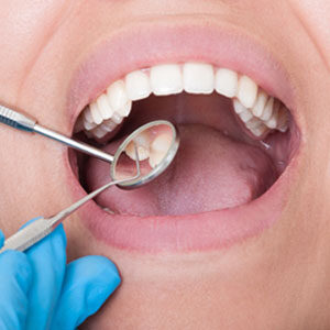 mouth2 Dentist looking in patients month
